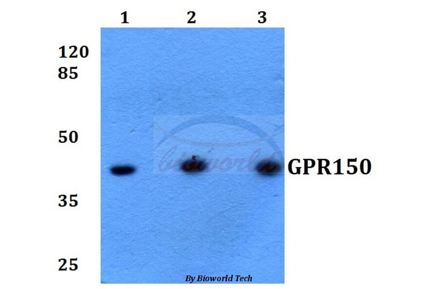 Anti-GPR150 (Q391) Antibody from Bioworld Technology (BS2702) - Antibodies.com