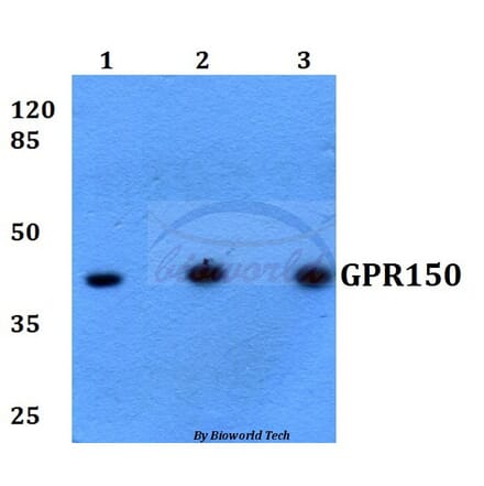Anti-GPR150 (Q391) Antibody from Bioworld Technology (BS2702) - Antibodies.com