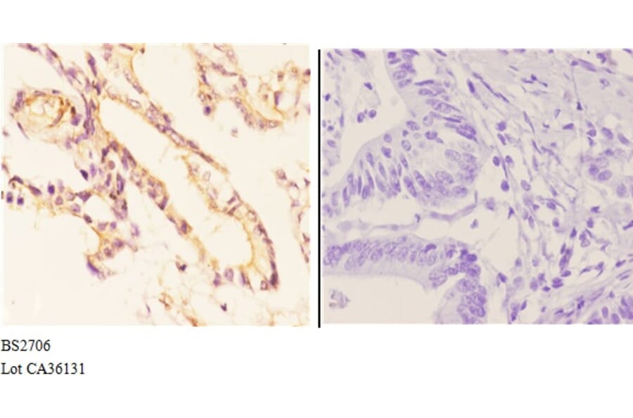 Anti-ADORA2A (Y361) Antibody from Bioworld Technology (BS2706) - Antibodies.com