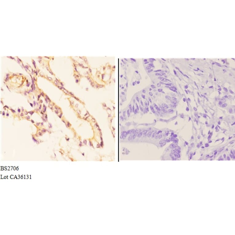 Anti-ADORA2A (Y361) Antibody from Bioworld Technology (BS2706) - Antibodies.com