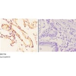 Anti-ADORA2A (Y361) Antibody from Bioworld Technology (BS2706) - Antibodies.com