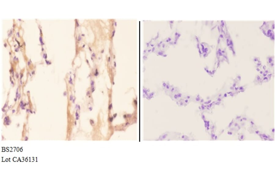 Anti-ADORA2A (Y361) Antibody from Bioworld Technology (BS2706) - Antibodies.com