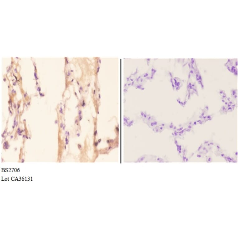 Anti-ADORA2A (Y361) Antibody from Bioworld Technology (BS2706) - Antibodies.com