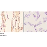 Anti-ADORA2A (Y361) Antibody from Bioworld Technology (BS2706) - Antibodies.com