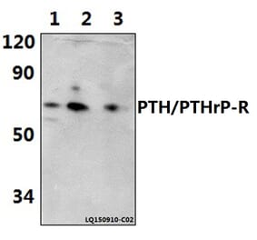 Anti-PTH/PTHrP-R (L187) Antibody from Bioworld Technology (BS2710) - Antibodies.com