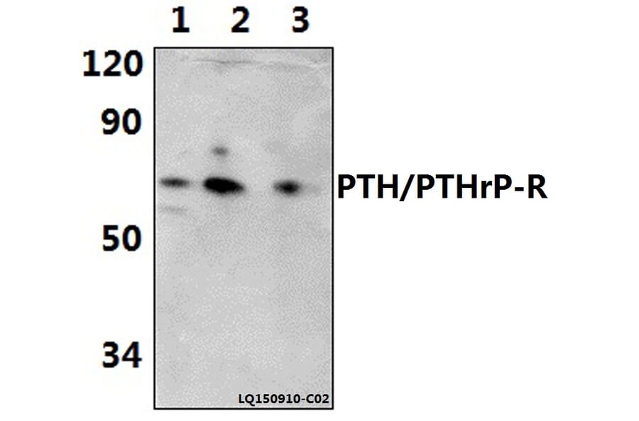 Anti-PTH/PTHrP-R (L187) Antibody from Bioworld Technology (BS2710) - Antibodies.com