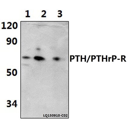Anti-PTH/PTHrP-R (L187) Antibody from Bioworld Technology (BS2710) - Antibodies.com