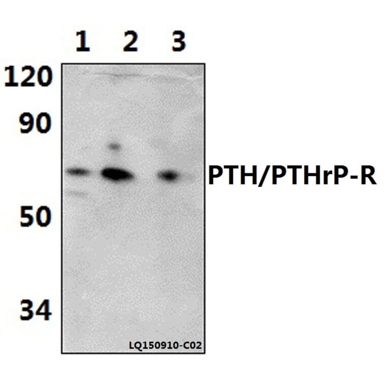 Anti-PTH/PTHrP-R (L187) Antibody from Bioworld Technology (BS2710) - Antibodies.com