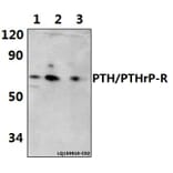 Anti-PTH/PTHrP-R (L187) Antibody from Bioworld Technology (BS2710) - Antibodies.com