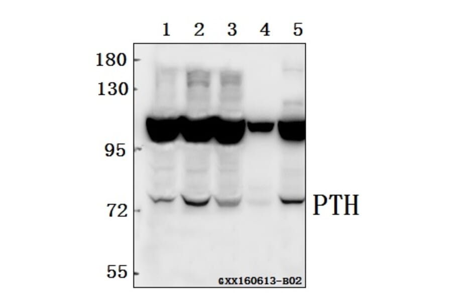 Anti-PTH/PTHrP-R (L187) Antibody from Bioworld Technology (BS2710) - Antibodies.com