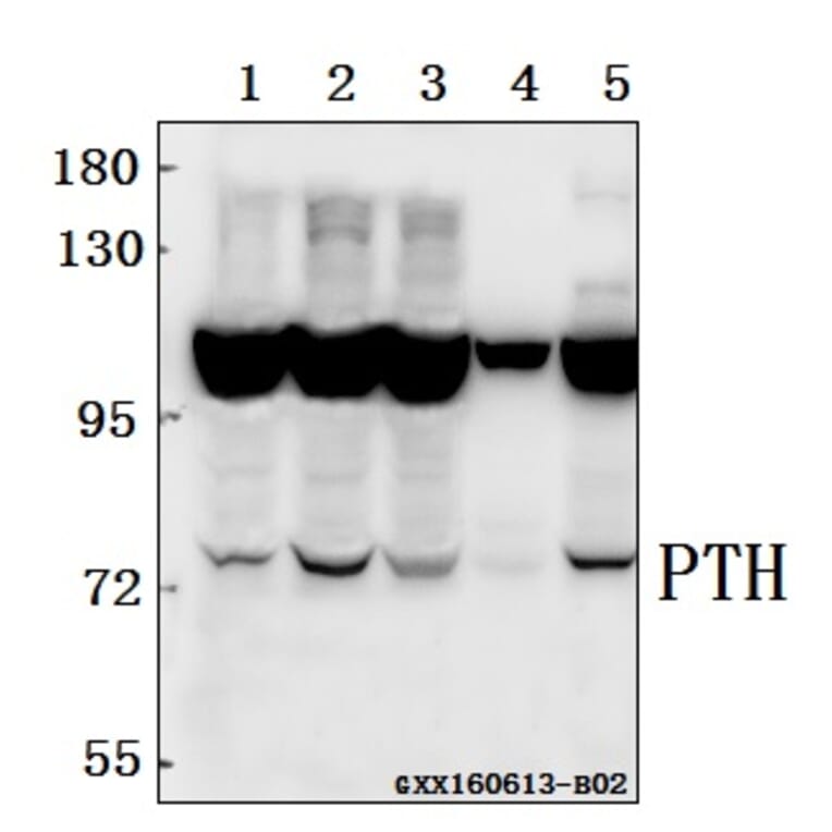 Anti-PTH/PTHrP-R (L187) Antibody from Bioworld Technology (BS2710) - Antibodies.com