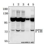 Anti-PTH/PTHrP-R (L187) Antibody from Bioworld Technology (BS2710) - Antibodies.com