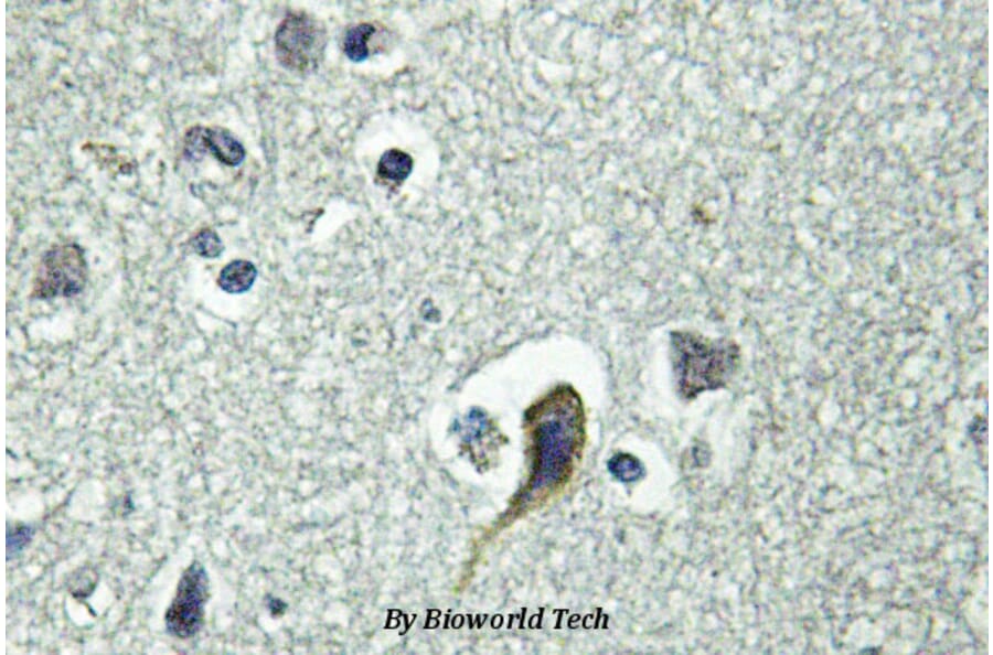Anti-PTH/PTHrP-R (L187) Antibody from Bioworld Technology (BS2710) - Antibodies.com