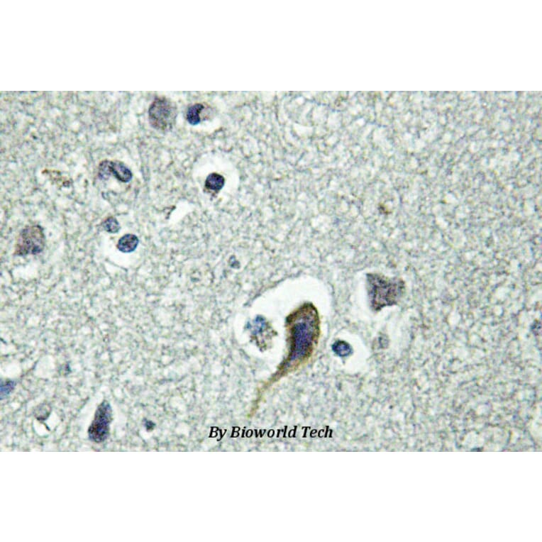 Anti-PTH/PTHrP-R (L187) Antibody from Bioworld Technology (BS2710) - Antibodies.com