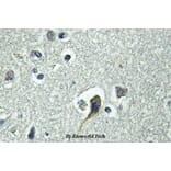 Anti-PTH/PTHrP-R (L187) Antibody from Bioworld Technology (BS2710) - Antibodies.com
