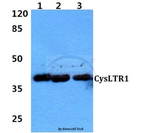 Anti-CysLTR1 (K172) Antibody from Bioworld Technology (BS2711) - Antibodies.com