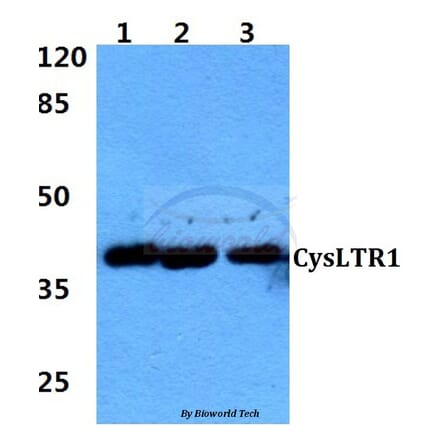 Anti-CysLTR1 (K172) Antibody from Bioworld Technology (BS2711) - Antibodies.com