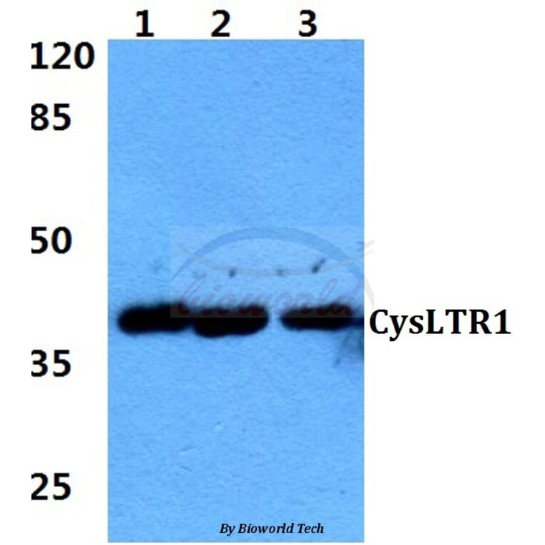 Anti-CysLTR1 (K172) Antibody from Bioworld Technology (BS2711) - Antibodies.com