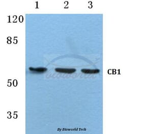 Anti-CB1 (F189) Antibody from Bioworld Technology (BS2712) - Antibodies.com