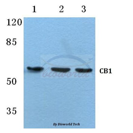 Anti-CB1 (F189) Antibody from Bioworld Technology (BS2712) - Antibodies.com