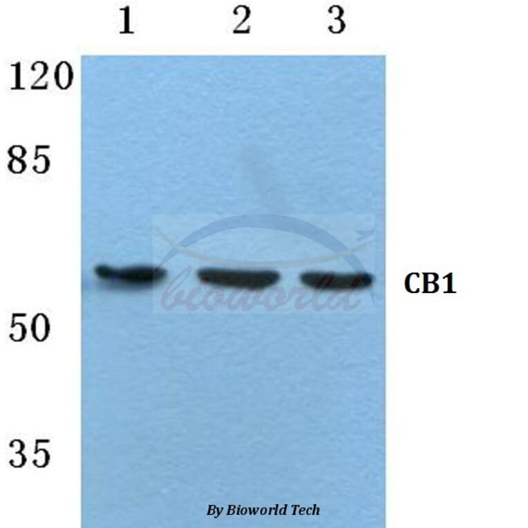 Anti-CB1 (F189) Antibody from Bioworld Technology (BS2712) - Antibodies.com