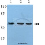 Anti-CB1 (F189) Antibody from Bioworld Technology (BS2712) - Antibodies.com