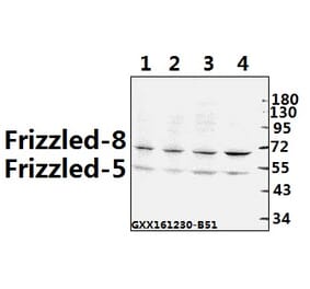 Anti-Frizzled-8 (K528) Antibody from Bioworld Technology (BS2715) - Antibodies.com