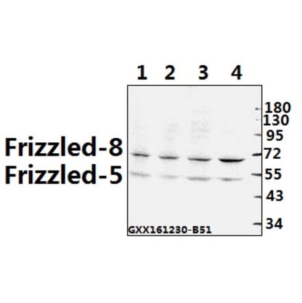 Anti-Frizzled-8 (K528) Antibody from Bioworld Technology (BS2715) - Antibodies.com