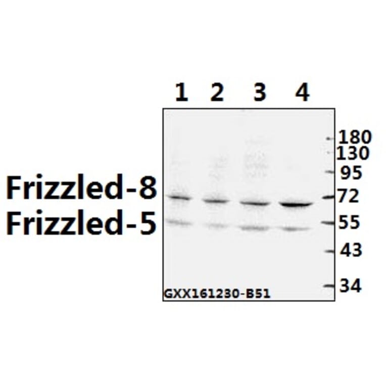 Anti-Frizzled-8 (K528) Antibody from Bioworld Technology (BS2715) - Antibodies.com