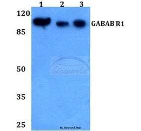 Anti-GABAB R1 (P931) Antibody from Bioworld Technology (BS2717) - Antibodies.com