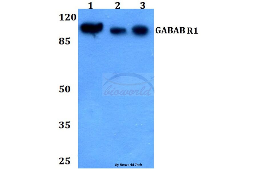 Anti-GABAB R1 (P931) Antibody from Bioworld Technology (BS2717) - Antibodies.com