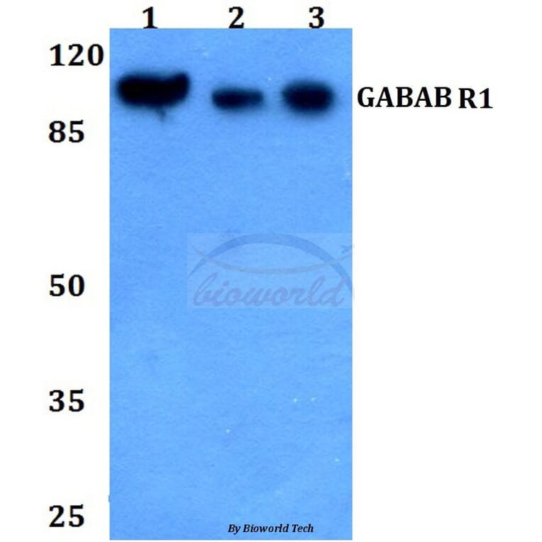 Anti-GABAB R1 (P931) Antibody from Bioworld Technology (BS2717) - Antibodies.com