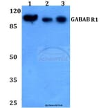Anti-GABAB R1 (P931) Antibody from Bioworld Technology (BS2717) - Antibodies.com