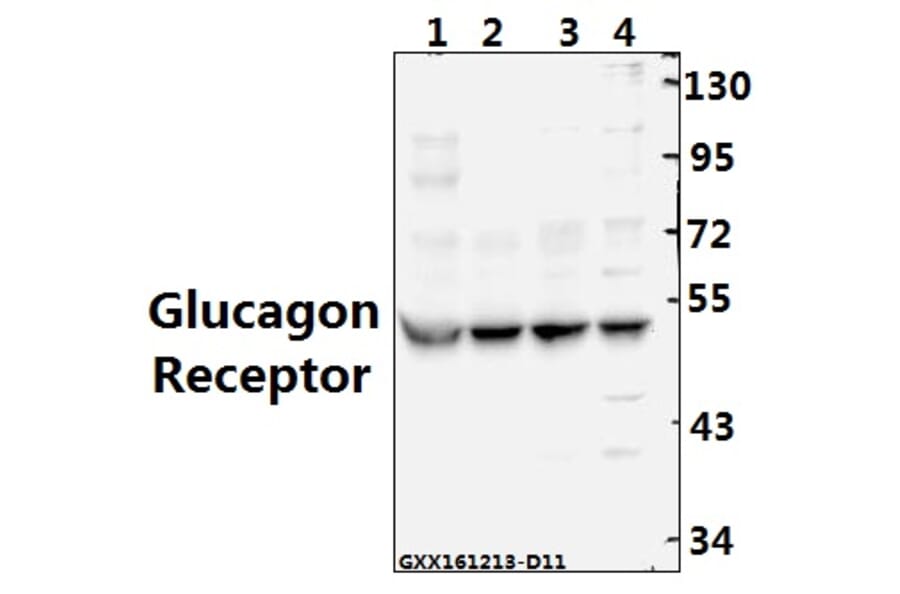 Anti-Glucagon Receptor (K136) Antibody from Bioworld Technology (BS2718) - Antibodies.com