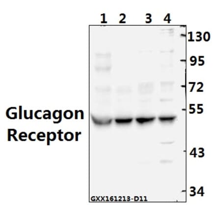 Anti-Glucagon Receptor (K136) Antibody from Bioworld Technology (BS2718) - Antibodies.com