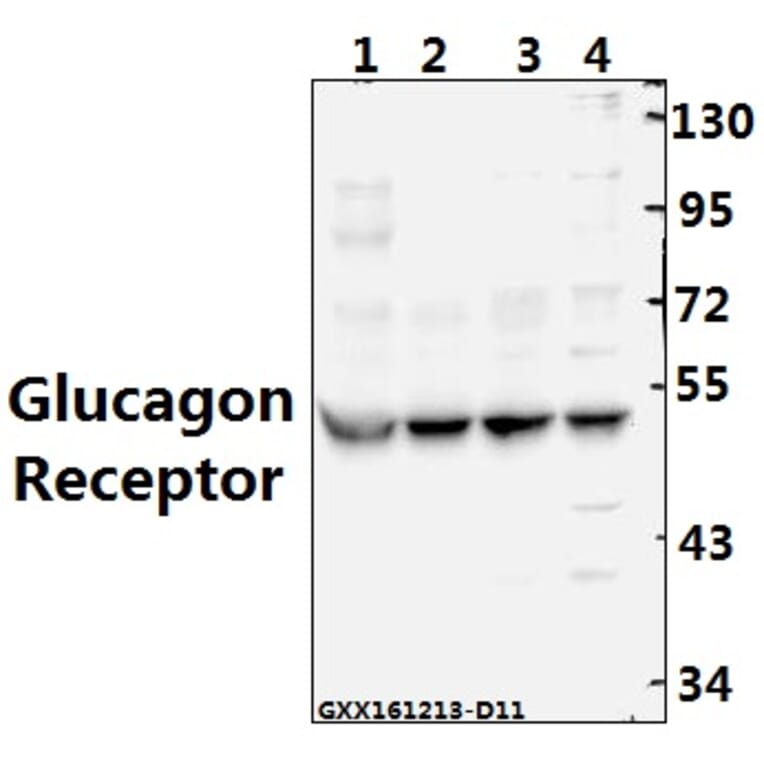 Anti-Glucagon Receptor (K136) Antibody from Bioworld Technology (BS2718) - Antibodies.com