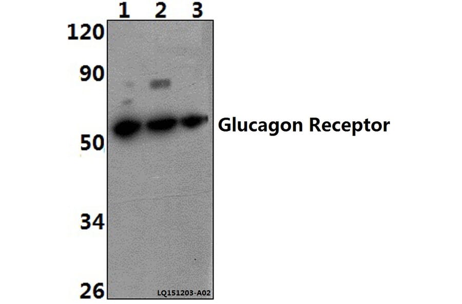 Anti-Glucagon Receptor (K136) Antibody from Bioworld Technology (BS2718) - Antibodies.com