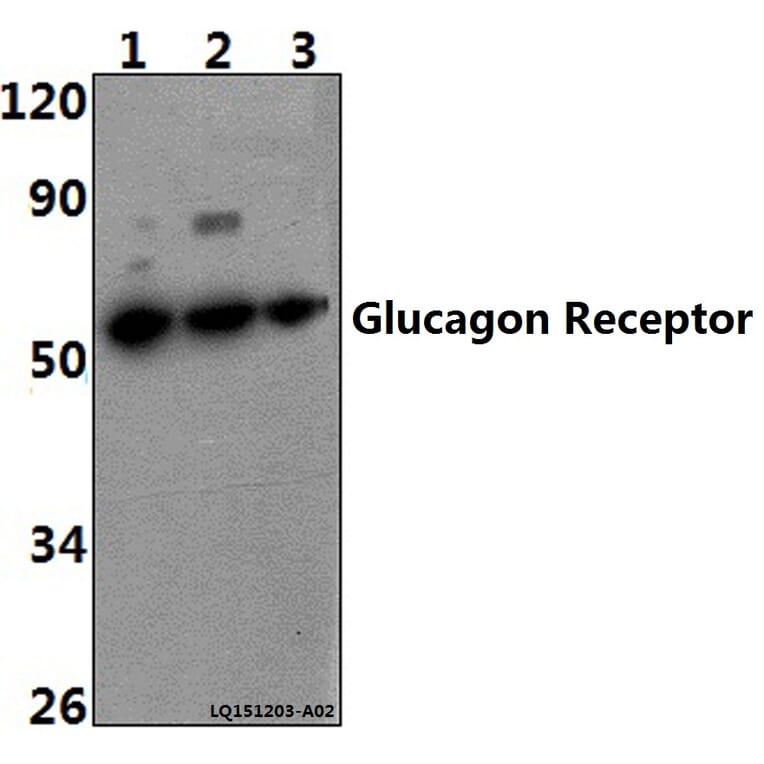 Anti-Glucagon Receptor (K136) Antibody from Bioworld Technology (BS2718) - Antibodies.com