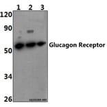 Anti-Glucagon Receptor (K136) Antibody from Bioworld Technology (BS2718) - Antibodies.com