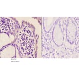 Anti-mGluR-5 (K56) Antibody from Bioworld Technology (BS2732) - Antibodies.com