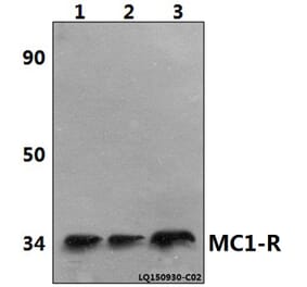 Anti-MC1-R (V312) Antibody from Bioworld Technology (BS2735) - Antibodies.com