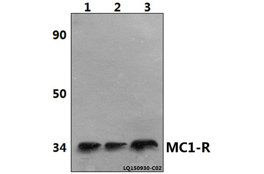 Anti-MC1-R (V312) Antibody from Bioworld Technology (BS2735) - Antibodies.com