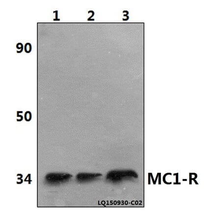 Anti-MC1-R (V312) Antibody from Bioworld Technology (BS2735) - Antibodies.com