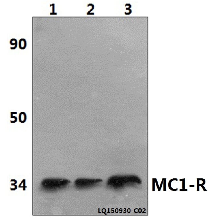 Anti-MC1-R (V312) Antibody from Bioworld Technology (BS2735) - Antibodies.com