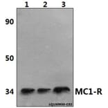 Anti-MC1-R (V312) Antibody from Bioworld Technology (BS2735) - Antibodies.com