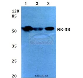Anti-NK-3R (P434) Antibody from Bioworld Technology (BS2736) - Antibodies.com
