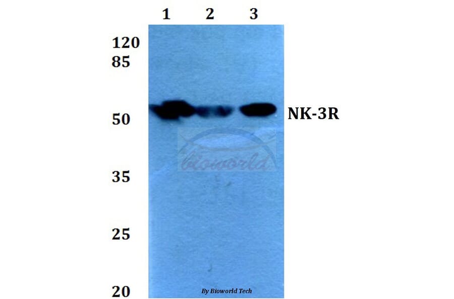 Anti-NK-3R (P434) Antibody from Bioworld Technology (BS2736) - Antibodies.com