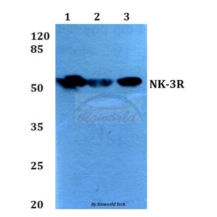 Anti-NK-3R (P434) Antibody from Bioworld Technology (BS2736) - Antibodies.com