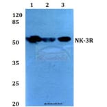 Anti-NK-3R (P434) Antibody from Bioworld Technology (BS2736) - Antibodies.com