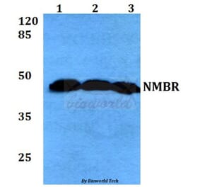 Anti-NMBR (L264) Antibody from Bioworld Technology (BS2737) - Antibodies.com